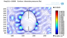 From Music to Non-Invasive Therapies via COMSOL Multiphysics® Models