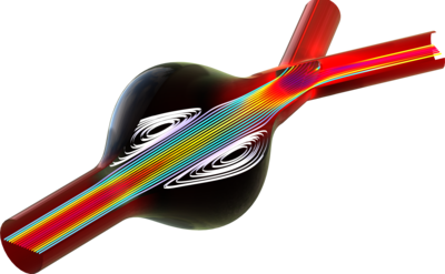 Abdominales Aortenaneurysma