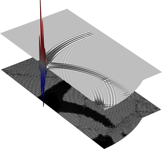 High-Intensity Focused Ultrasound (HIFU)