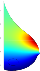 Early Breast Cancer Detection using Patient Symptomatic Breast Images by ...