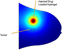 Modeling of Hydrogel-Based Controlled Drug Delivery System for Breast ...