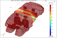 Loudspeaker Simulations in a Car Cabin