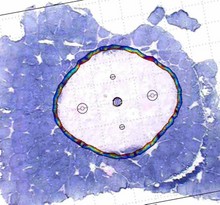 Finite Element Analysis of Muscular Contractions from DC Pulses in the Liver