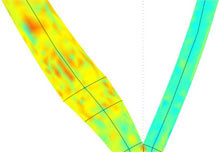 Mathematical Model of Blood Flow in Carotid Bifurcation