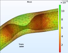 Fluid-Structure Interaction Studies of Coronary Artery Disease Biomechanics