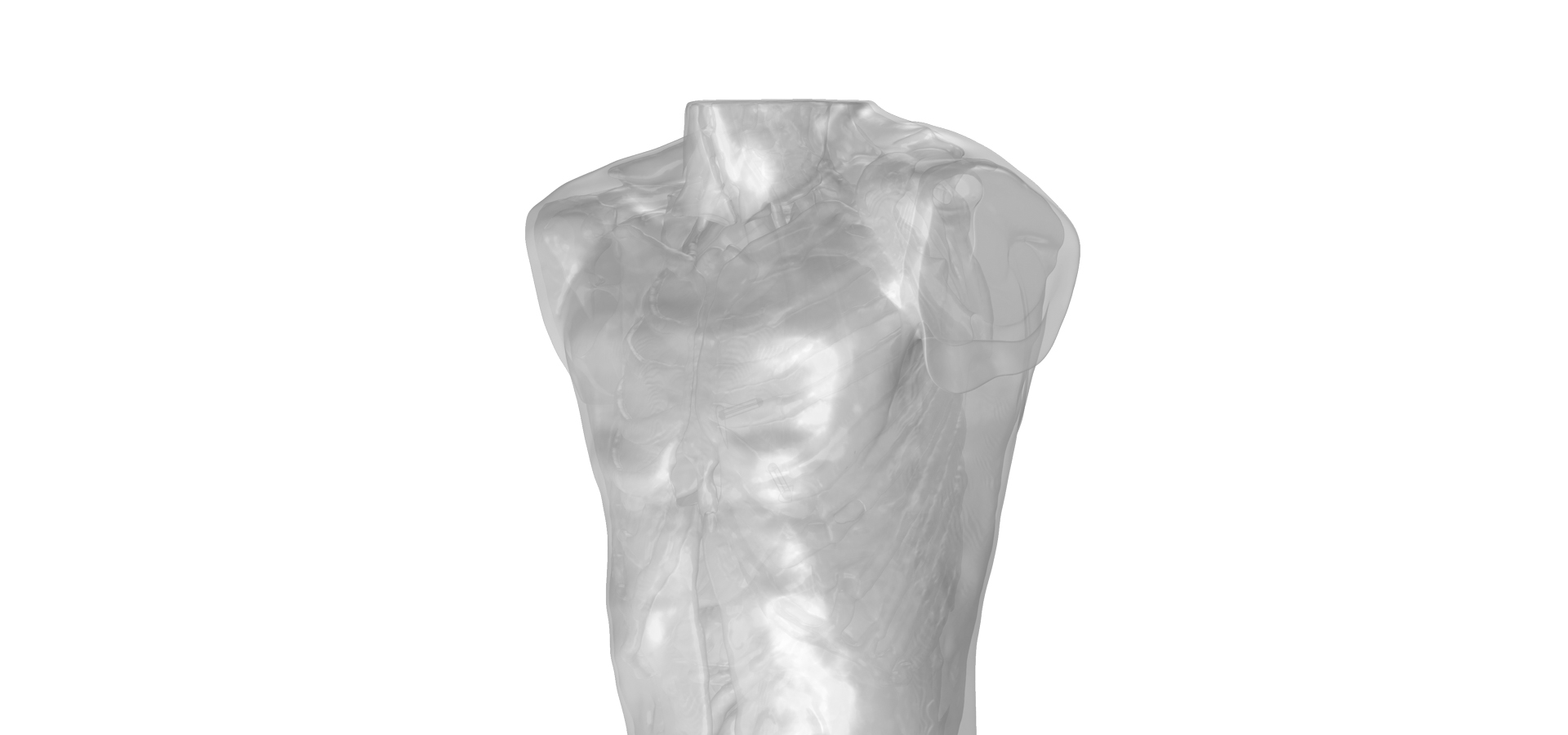 MicroPort CRM Optimizes Leadless Cardiac Pacemaker Communication 